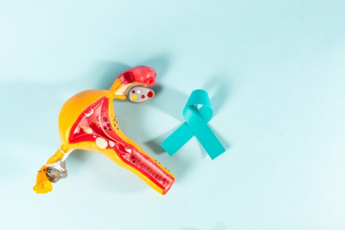 Understanding and Managing Ovarian Cysts