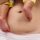 Postpartum abdomen with a horizontal cesarean scar, baby’s leg resting on the belly next to the scar.